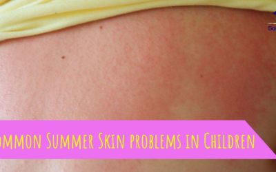 Common Summer Skin problems in Children